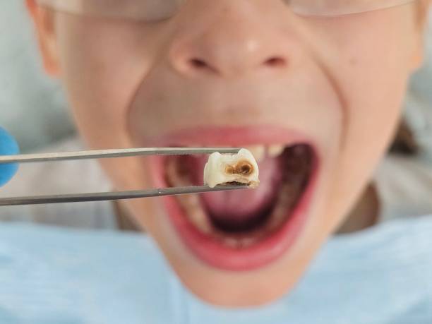 Best Emergency Dentist for Kids  in Tamaqua, PA